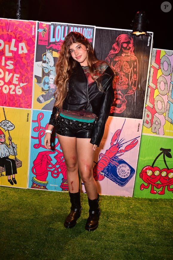 Veja como ficaram os machucados de Sofia Massafera após a queda na escada do Lollapalooza