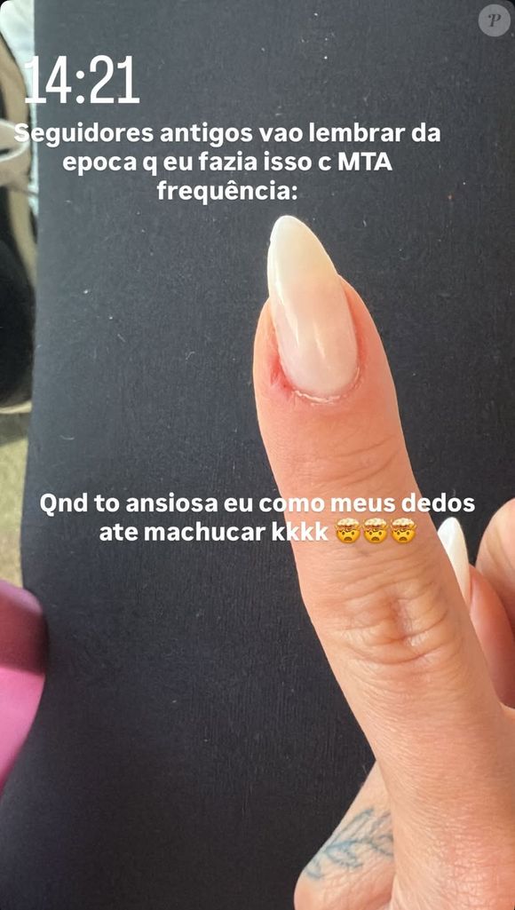 Virgínia Fonseca exibiu o dedo com uma pequena ferida: ‘Quando tô ansiosa, como meus dedos até machucar’