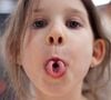 Girl rolling tongue into tube, close up. Articulation logopedic for mouth, speech therapy, tongue gymnastics concept.