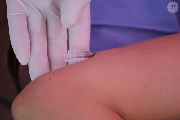 O chip hormonal é um implante subcutâneo que libera hormônios de forma contínua e é mais conhecido como método contraceptivo. Neste caso, é utilizado progesterona