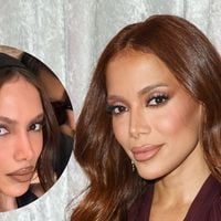 Antes e depois de Anitta: cantora reaparece pela 1ª vez após infecção bacteriana e aparência MUITO diferente choca. 'Mexeu em tudo'