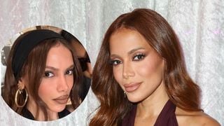 Antes e depois de Anitta: cantora reaparece pela 1ª vez após infecção bacteriana e aparência MUITO diferente choca. 'Mexeu em tudo'