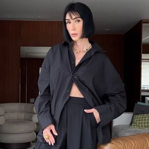 Sem preenchedores, lifting escolhido por Michelle Barros é de alta tecnologia e promove um rejuvenescimento impressionante