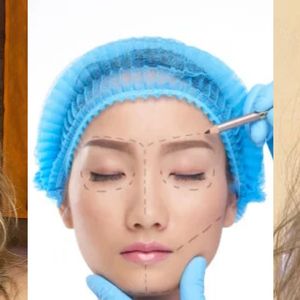 Nem silicone, nem lipo HD: Brasil é TOP1 do ranking mundial de cirurgia plástica feita por Luana Piovani, Letícia Spiller e mais famosas