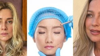 Nem silicone, nem lipo HD: Brasil é TOP1 do ranking mundial de cirurgia plástica feita por Luana Piovani, Letícia Spiller e mais famosas