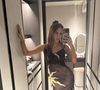 Ao longo de sua carreira, Anitta já fez mais de 50 procedimentos estéticos em seu rosto e corpo