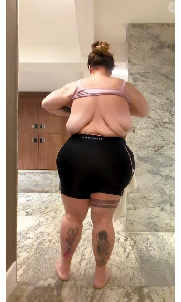 Thais Carla já revelou que pretende fazer a cirurgia de remoção do excesso de pele, mas não entregou quando