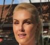Tudo sobre os 6 protocolos estéticos faciais de Ana Hickmann, aos 45 anos, antes do casamento com Edu Guedes