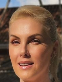 Laser Thulium para efeito glow na pele, radiofrequência Xerf para estimular colágeno, skinboosters e mais: um raio-x de 6 protocolos estéticos faciais de Ana Hickmann, aos 45 anos, antes do casamento com Edu Guedes