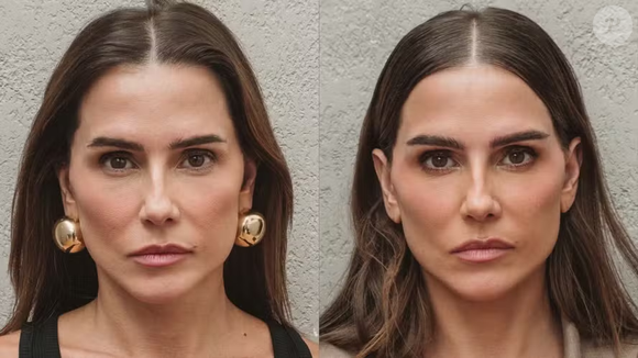 Várias anônimas e famosas, como Débora Secco, já recorreram às técnicas de micropigmentação ou transplante de sobrancelhas, para deixar o visual mais harmônico.