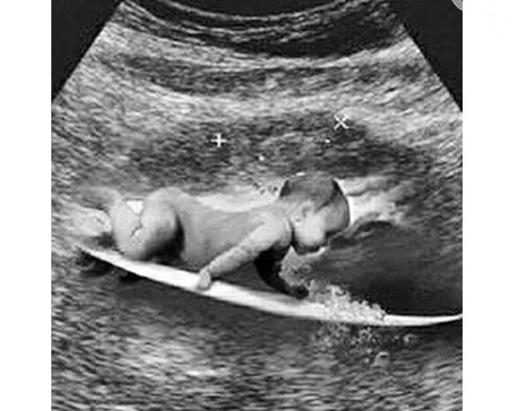 Gabriel Medina publicou uma montagem de um ultrassom, que mostra um bebê com uma prancha