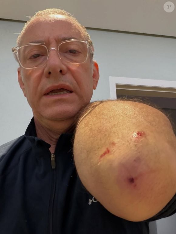 ‘Ele avançou e nos feriu’, disse José Roberto Burnier ao comentar ataque de pitbull sem guia.