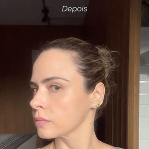 No 'BBB 26' Ana Paula Renault passou a ser referência para quem busca beleza sem exageros, especialmente entre mulheres que valorizam praticidade e cuidado com a pele