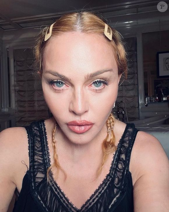 Antes e depois de Madonna em 50 fotos: lifting, rinoplastia e preenchimento estão na lista de intervenções suspeitas entre fãs e especialistas