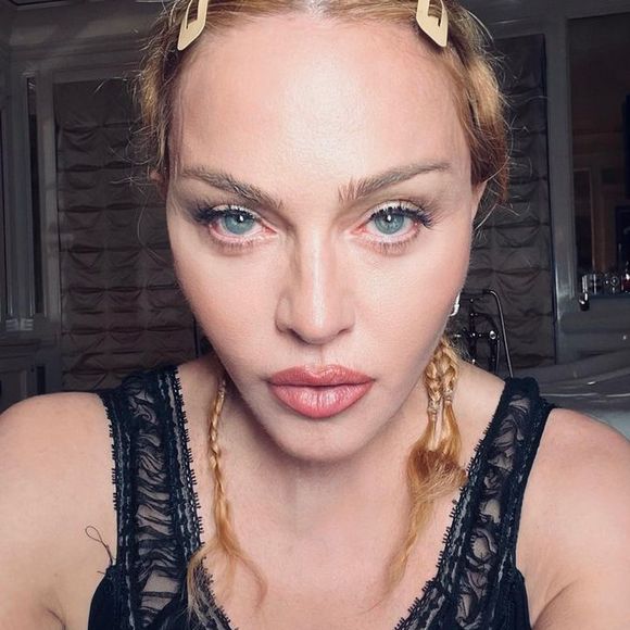Antes e depois de Madonna em 50 fotos: lifting, rinoplastia e preenchimento estão na lista de intervenções suspeitas entre fãs e especialistas