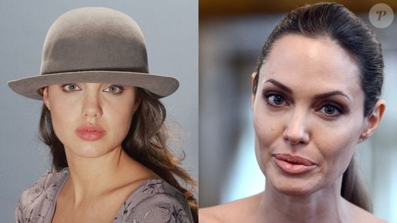 Antes e depois de Angelina Jolie: atriz emagreceu muito e mudou os traços do seu rosto com o passar dos anos