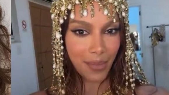 ‘Enganou todo mundo’: Anitta reaparece com rosto mais natural após procedimentos estéticos e confunde fãs; compare o antes e depois