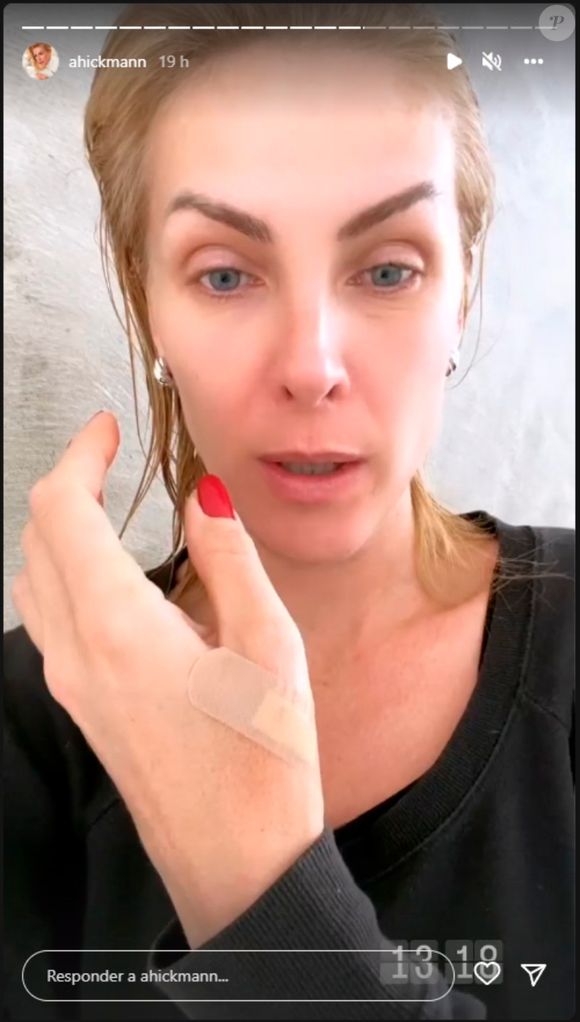 Ana Hickmann acusou Alexandre Correa de agressão