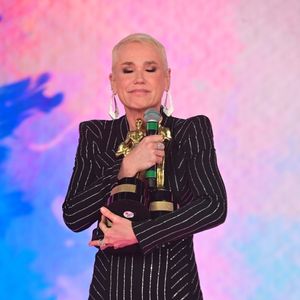 Xuxa Meneghel revelou ter passado por transplante capilar por enfrentar doença genética e cogitou raspar a cabeça