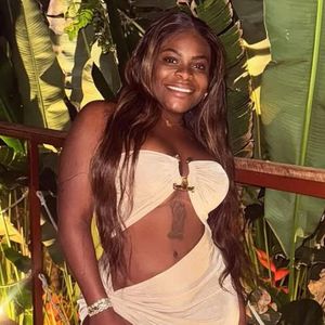 Quando Jojo Todynho vai mostrar o corpo após novas cirurgia? Cantora revela inchaço e edemas nas pernas: 'Bastante roxo'