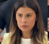 Novo nariz de Simone Mendes não é rinoplastia: cantora revela o que fez e especialista explica por que ponta ficou 'meio porquinho': 'Fica mais levantadinho'