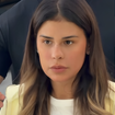 Novo nariz de Simone Mendes não é rinoplastia: cantora revela o que fez e especialista explica por que ponta ficou 'meio porquinho': 'Fica mais levantadinho'