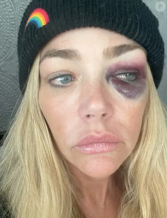 "Aaron frequentemente me estrangulava violentamente, apertava minha cabeça com as duas mãos, apertava meus braços com força, me dava tapas violentos no rosto e na cabeça, batia minha cabeça agressivamente no toalheiro do banheiro, ameaçava me matar", afirmou a atriz.