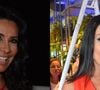 Embora divida opiniões pelos seus exageros estéticos, Scheila Carvalho também aplica o botox para segurar a pele e rugas