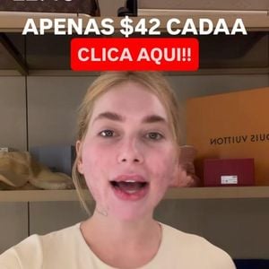 Pós-procedimento chama atenção nas redes e Virgínia Fonseca garante que não houve complicações após tratamento facial