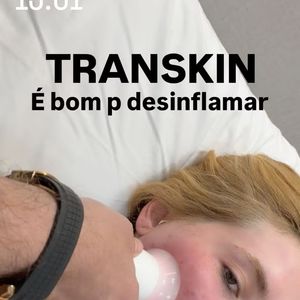 Virgínia aplicou o UltraPulse Alpha, um laser de CO₂ de alta potência, subcisão e exossomos vegetais