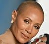 Alopecia areata afeta Jada Pinkett Smith e, geralmente, é caracterizada por pequenas áreas arredondadas no couro cabeludo