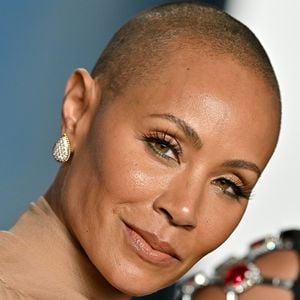 Alopecia areata afeta Jada Pinkett Smith e, geralmente, é caracterizada por pequenas áreas arredondadas no couro cabeludo
