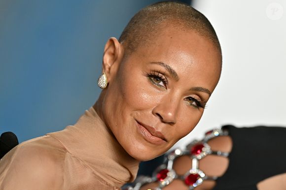 Alopecia areata afeta Jada Pinkett Smith e, geralmente, é caracterizada por pequenas áreas arredondadas no couro cabeludo