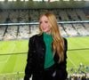 A especialista aponta que Marina Ruy Barbosa pode ter feito o preenchimento no malar, região que ressalta a marca do blush