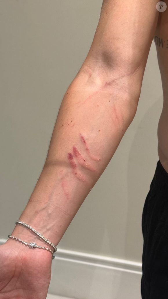 Documento técnico aponta ofensa à integridade corporal e reforça versão apresentada pelo médico Danilo Bravo, segundo apuração de Fábia Oliveira