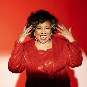 Espondilolistese, que afeta Alcione, é uma condição em que uma vértebra escorrega para frente em relação à vértebra logo abaixo, geralmente na região lombar