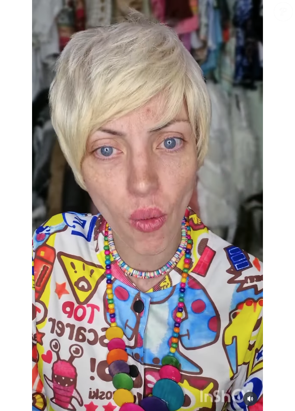 Barbie Humana já vinha preocupando fãs por sua transformação na aparência