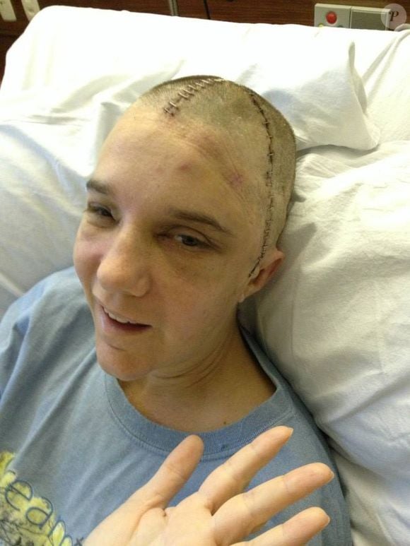 Inesperadamente, a recuperação de Renee Murdoch foi rápida, apesar de ter enfrentado alguns problemas na fala