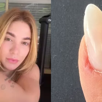 Chia, amêndoas e abacate: Virgínia revela crise de ansiedade e estes são os alimentos, segundo nutricionista, que ajudam a controlar o estresse e aliviar sintomas