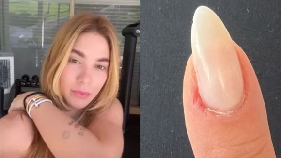 Chia, amêndoas e abacate: Virgínia revela crise de ansiedade e estes são os alimentos, segundo nutricionista, que ajudam a controlar o estresse e aliviar sintomas