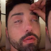 Era só o que faltava! Rico Melquíades quer serrar ossos das pernas para reduzir 4cm de altura: 'Minha coluna dói muito'