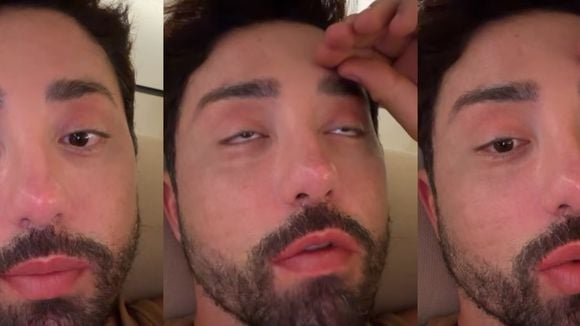 Era só o que faltava! Rico Melquíades quer serrar ossos das pernas para reduzir 4cm de altura: 'Minha coluna dói muito'