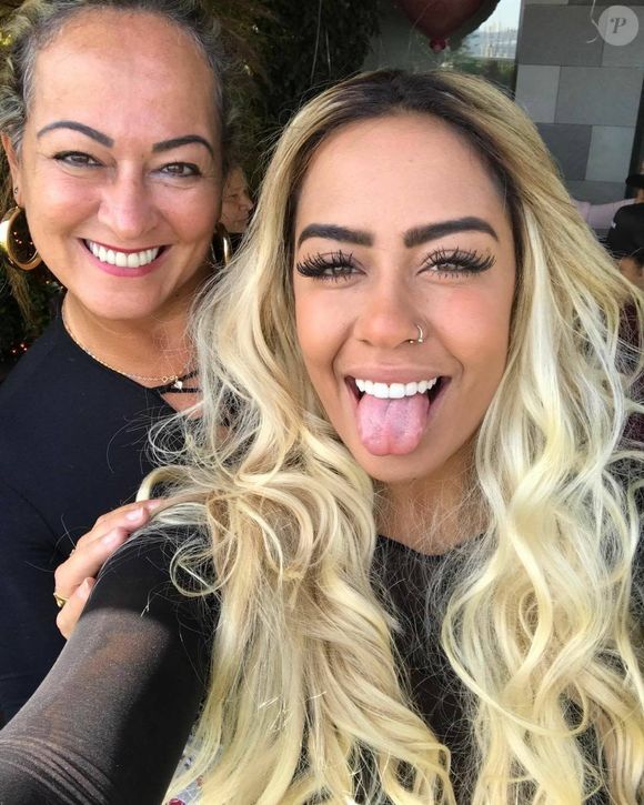 Tempo depois, Nadine Gonçalves aproveitou para mudar seu sorriso com facetas de resina