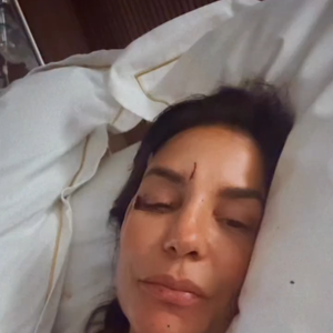 Ivete Sangalo afirma que desmaiou por conta da desidratação e machucou o rosto