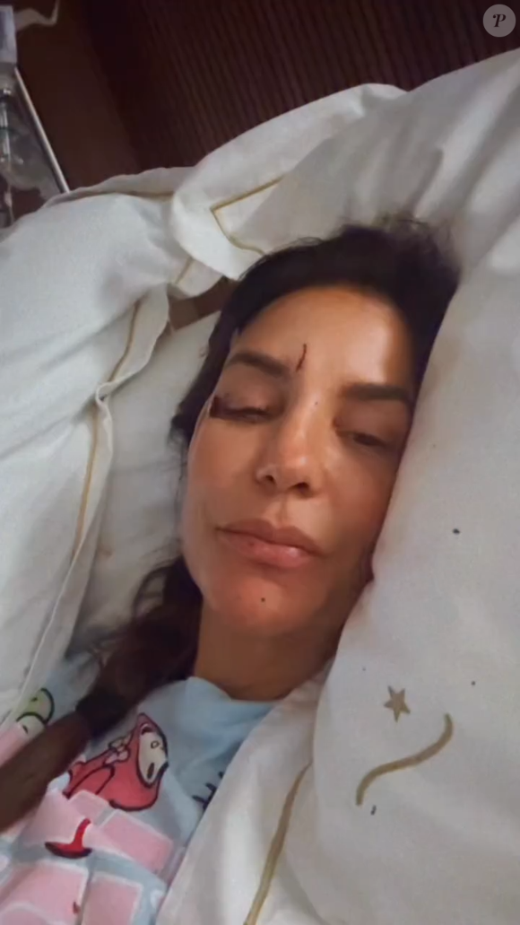 Ivete Sangalo afirma que desmaiou por conta da desidratação e machucou o rosto