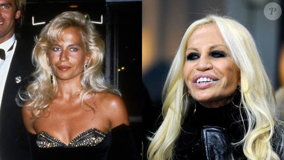 Antes e depois de Donatella Versace: famosa estilista transformou seu rosto e passou décadas gerando polêmica entre o público