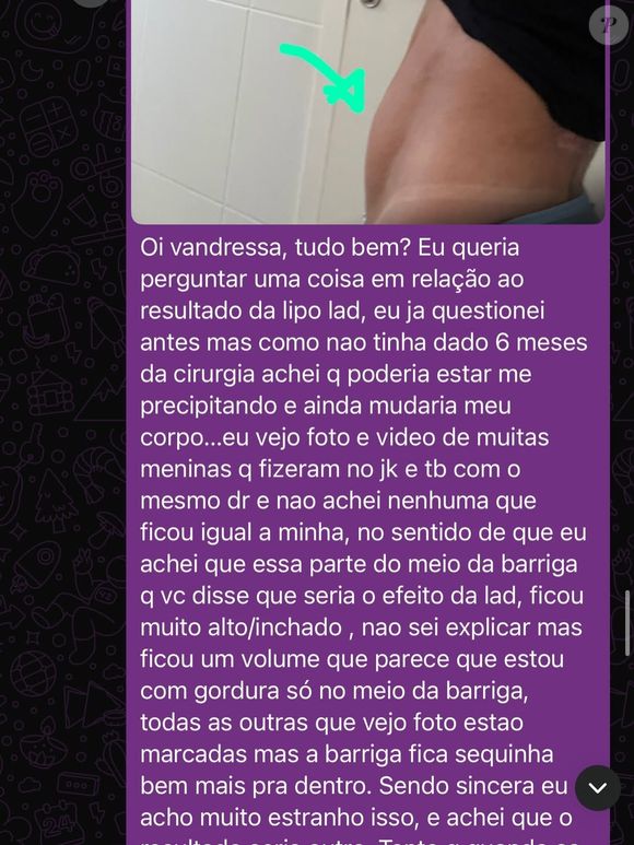 Mariana Tavares expôs mensagens que enviou para a clínica no pós-operatório