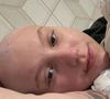 Isabel Veloso passou por transplante de medula óssea em outubro de 2025, mas enfrentou complicações