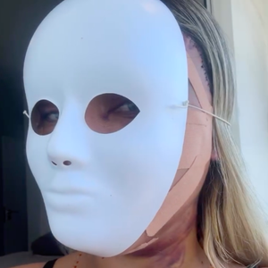Cirurgia feita por Andressa Urach reposiciona os músculos do rosto, promovendo o rejuvenescimento