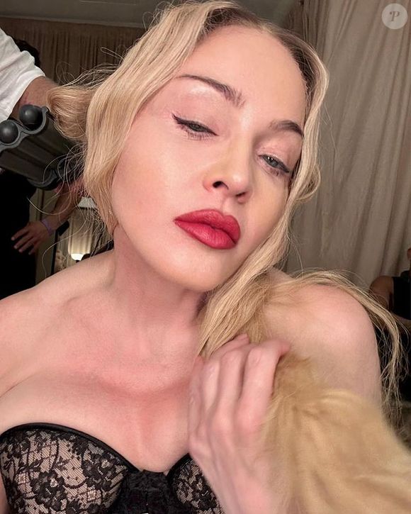 Antes e depois de Madonna em 50 fotos: lifting, rinoplastia e preenchimento estão na lista de intervenções suspeitas entre fãs e especialistas